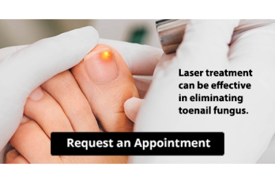 Try Laser Treatment For Toenail Fungus